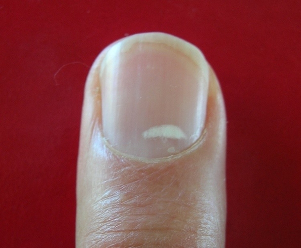 The Shape And Color Of Your Nails Say A Lot About Your Health... - picture 4