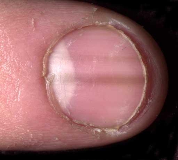 The Shape And Color Of Your Nails Say A Lot About Your Health... - picture 5