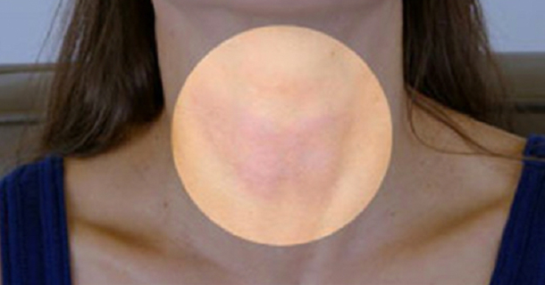 The Truth About Your Thyroid and Essential Oils: What No Endocrinologist Will Tell You - picture 2