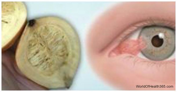 THE ULTIMATE REMEDY FOR BETTER VISION! TAKE ONE EVERY MORNING AND EVERY NIGHT YOU’LL HAVE 80% OF YOUR VISION RESTORED! - picture 2