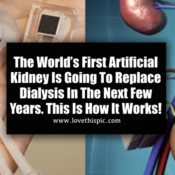 The World’s First Artificial Kidney Is Going To Replace Dialysis In The Next Few Years. This Is How It Works!