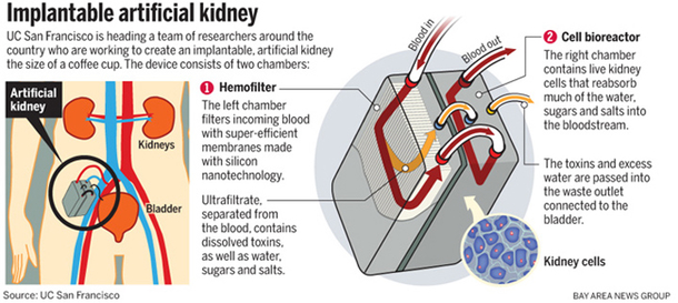 The World’s First Artificial Kidney Is Going To Replace Dialysis In The Next Few Years. This Is How It Works! - picture 4