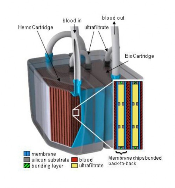 The World’s First Artificial Kidney Is Going To Replace Dialysis In The Next Few Years. This Is How It Works! - picture 5