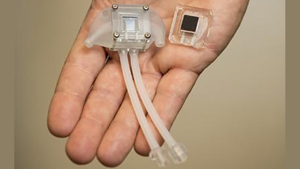 The World’s First Artificial Kidney Is Going To Replace Dialysis In The Next Few Years. This Is How It Works! - picture 6