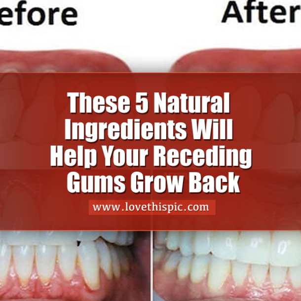 These 5 Natural Ingredients Will Help Your Receding Gums Grow Back