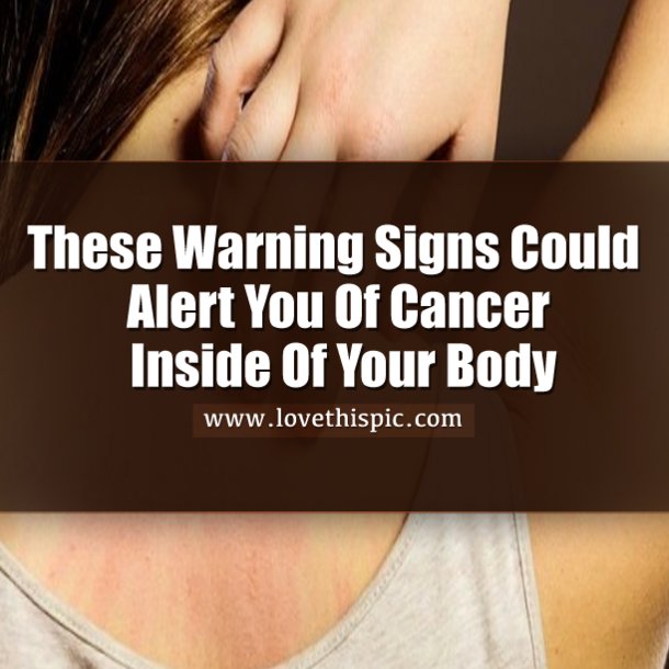 These Warning Signs Could Alert You Of Cancer Inside Of Your Body