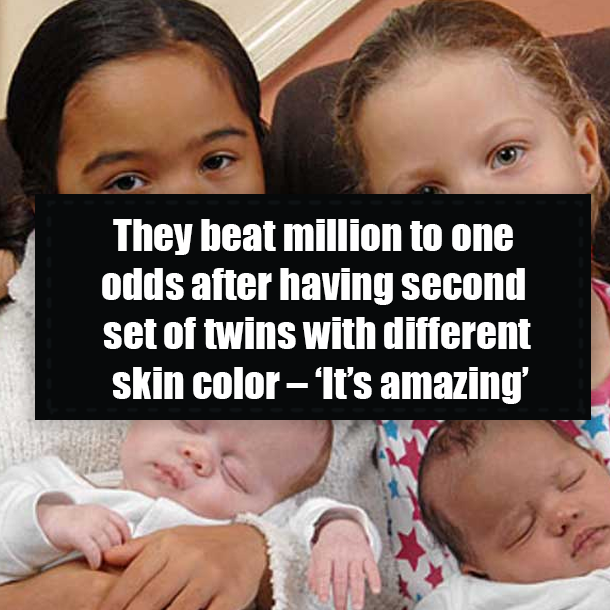 They beat million to one odds after having second set of twins with different skin color – ‘It’s amazing’