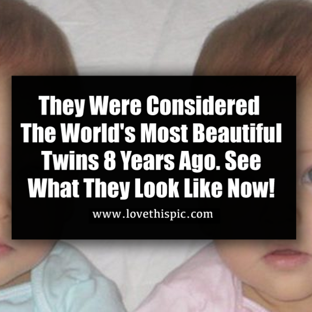 They Were Considered The World's Most Beautiful Twins 8 Years Ago. See What They Look Like Now!