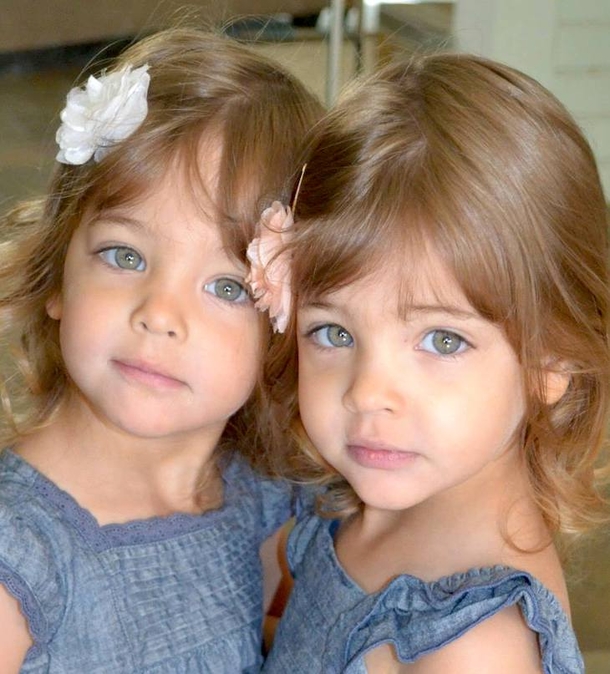They Were Considered The World's Most Beautiful Twins 8 Years Ago. See What They Look Like Now! - picture 2