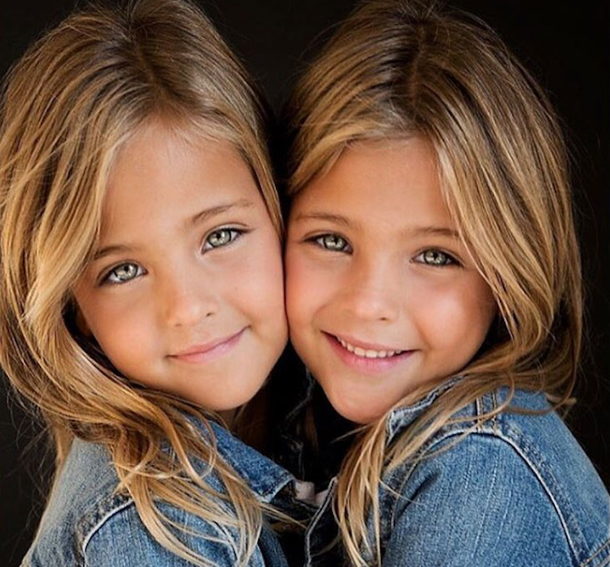 They Were Considered The World's Most Beautiful Twins 8 Years Ago. See What They Look Like Now! - picture 4