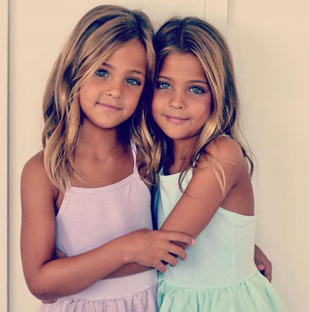 They Were Considered The World's Most Beautiful Twins 8 Years Ago. See What They Look Like Now! - picture 5