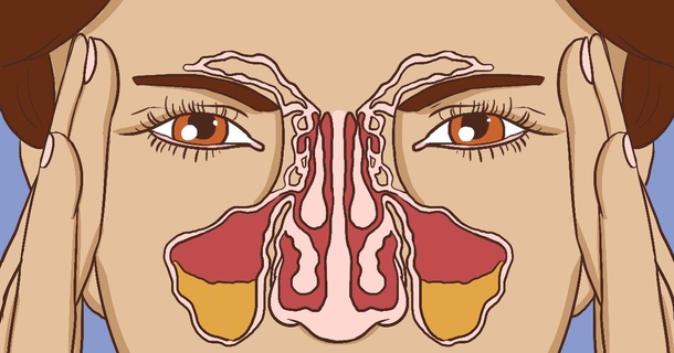 This 10 Minutes Home Remedy Is Your Secret Against Congestion - picture 2