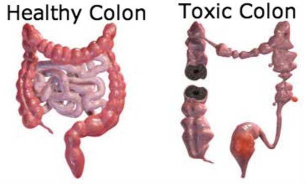 This 2-Ingredient Colon Cleansing Mixture Will Flush POUNDS of Waste from Your Waistline And Body - picture 3