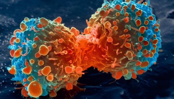 This Ancient Herb Kills Cancer Cells In 48 Hours And Is Much Better Than Chemotherapy... - picture 2