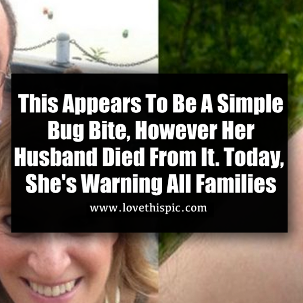 This Appears To Be A Simple Bug Bite, However Her Husband Died From It. Today, She's Warning All Families