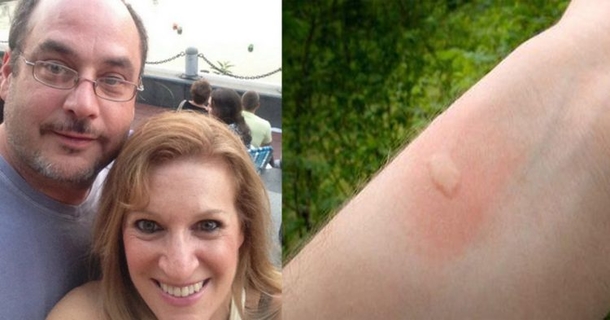 This Appears To Be A Simple Bug Bite, However Her Husband Died From It. Today, She's Warning All Families - picture 2