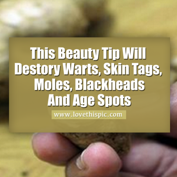 This Beauty Tip Will Destory Warts, Skin Tags, Moles, Blackheads And Age Spots