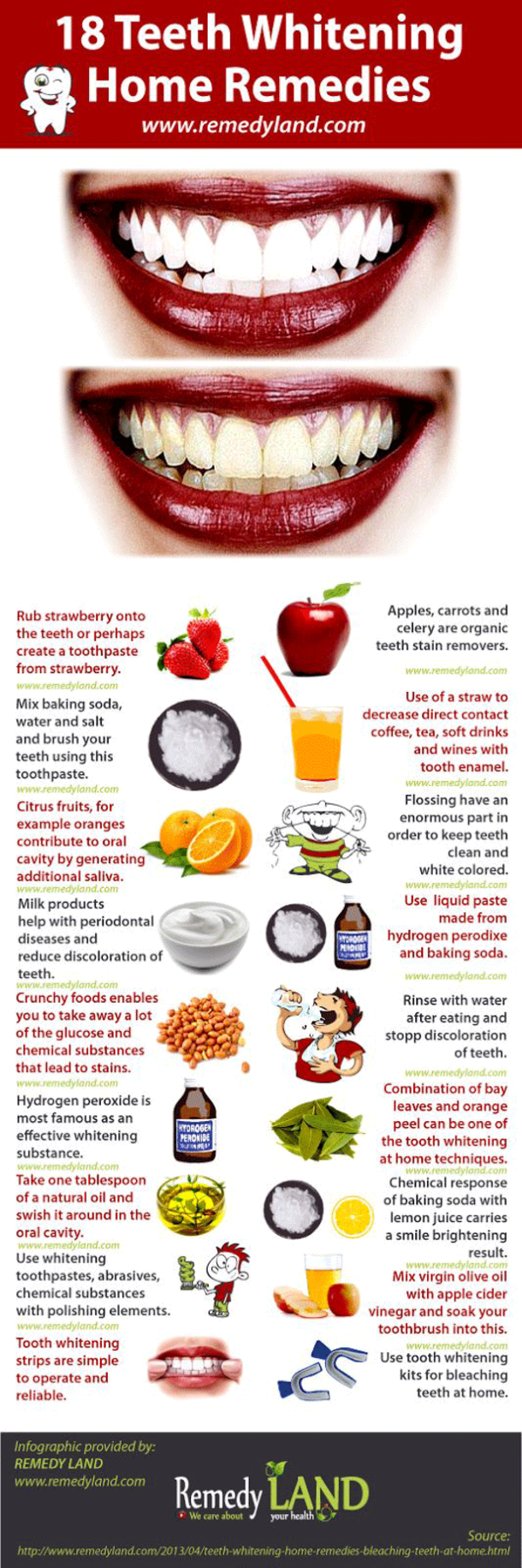 This Easy Remedy Will Help You Fight Tartar Build Up At Home - picture 2