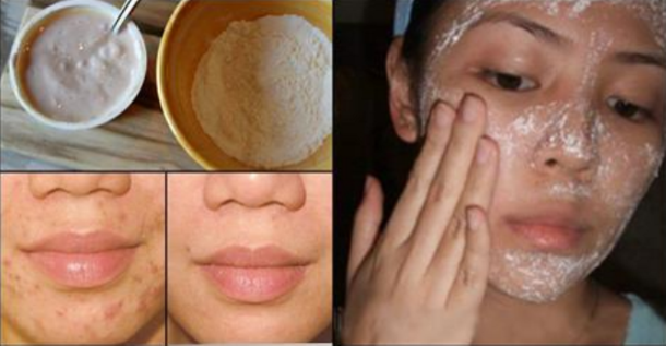 This Face Mask Removes Stains, Acne Scars And Wrinkles Magically! - picture 2