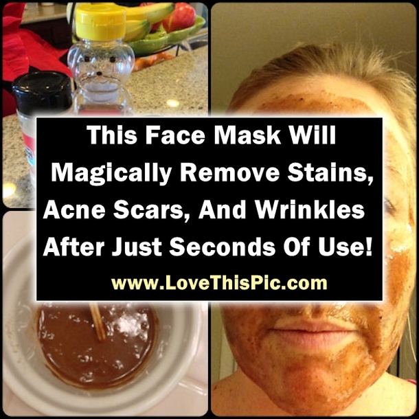 This Face Mask Will Magically Remove Stains, Acne Scars, And Wrinkles After Just Seconds Of Use!