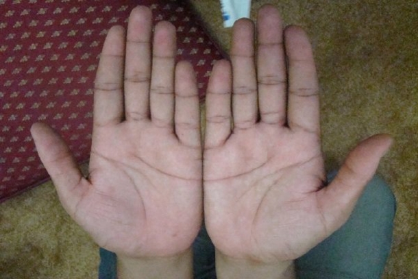 This Half Moon On Your Palm Tells You Alot About Your Personality... - picture 6