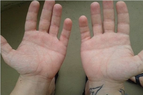 This Half Moon On Your Palm Tells You Alot About Your Personality... - picture 8