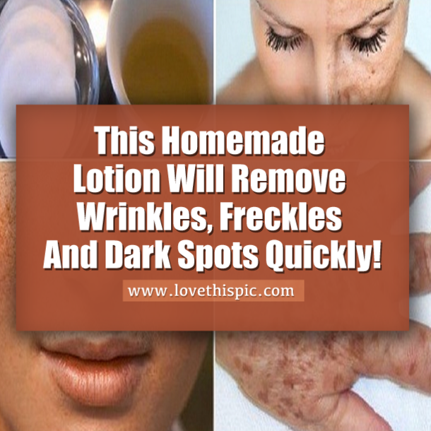 This Homemade Lotion Will Remove Wrinkles, Freckles And Dark Spots Quickly!