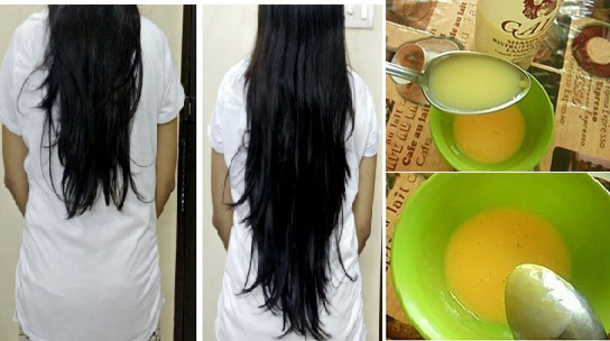 This Homemade Recipe Will Make Your Hair Grow In No Time At All! - picture 2
