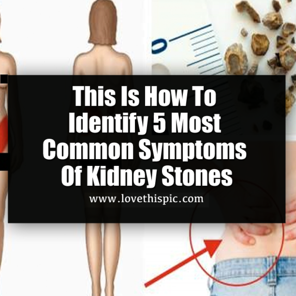 This Is How To Identify 5 Most Common Symptoms Of Kidney Stones