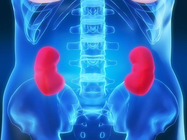 This Is How To Identify 5 Most Common Symptoms Of Kidney Stones - picture 6