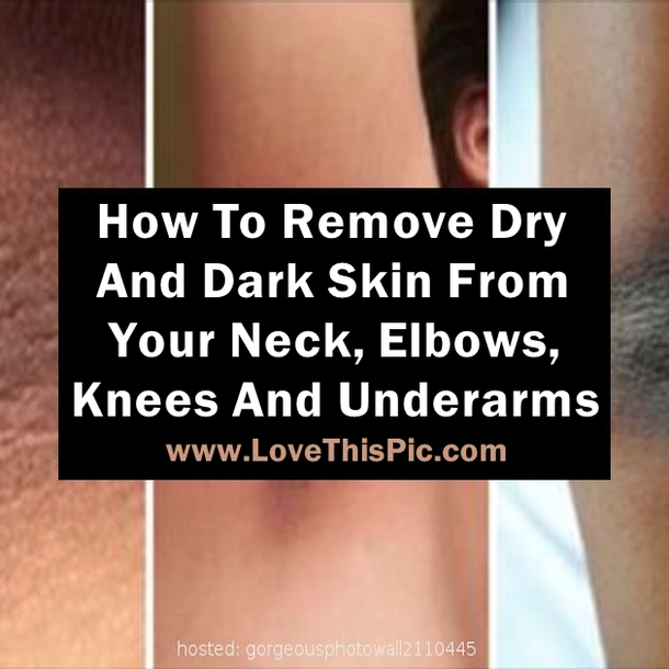 This Is How To Naturally Remove Dry And Dark Skin From Your Neck, Elbows, Knees And Underarms.