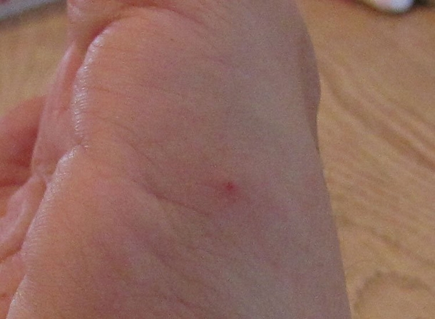 This Is No Ordinary Bug. If You See One, You Need To Do THIS Immediately... - picture 6