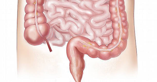 This Is The Easiest & Fastest Way To Get Rid of 20 Pounds of Toxins from Your Colon in Just 3 Weeks! - picture 2
