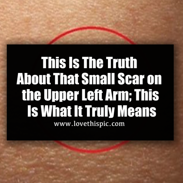 This Is The Truth About That Small Scar on the Upper Left Arm; This Is What It Truly Means
