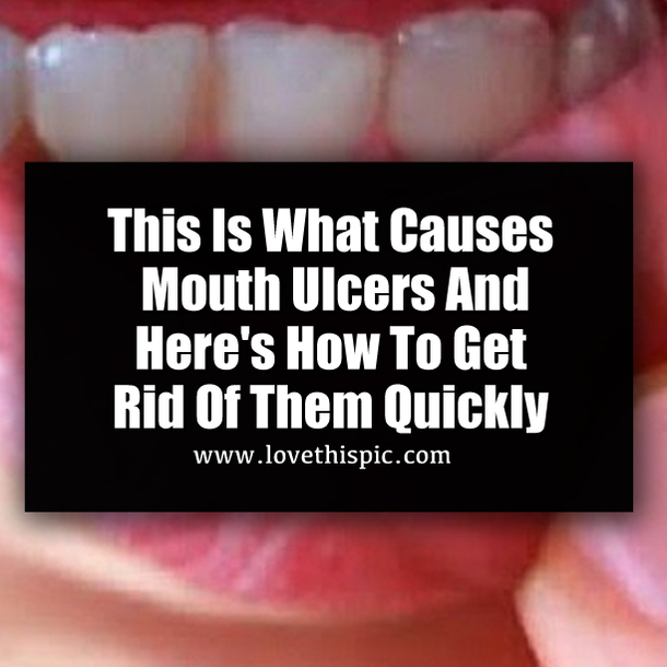 This Is What Causes Mouth Ulcers And Here's How To Get Rid Of Them Quickly