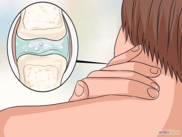 This Is What Happens To Your Body When You Crack Your Neck! - picture 3