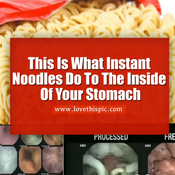 This Is What Instant Noodles Do To The Inside Of Your Stomach