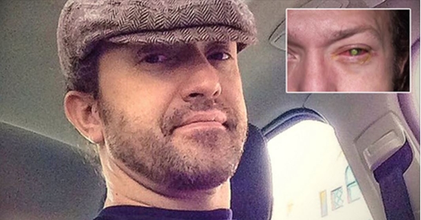 This Man Went Blind Because Of A Simple Mistake Many People Make All The Time! - picture 2