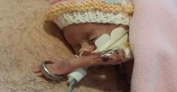 This Miracle Baby Was Not Supposed To Have Christmas With Her Parents, But She Proved Doctors Wrong - picture 5
