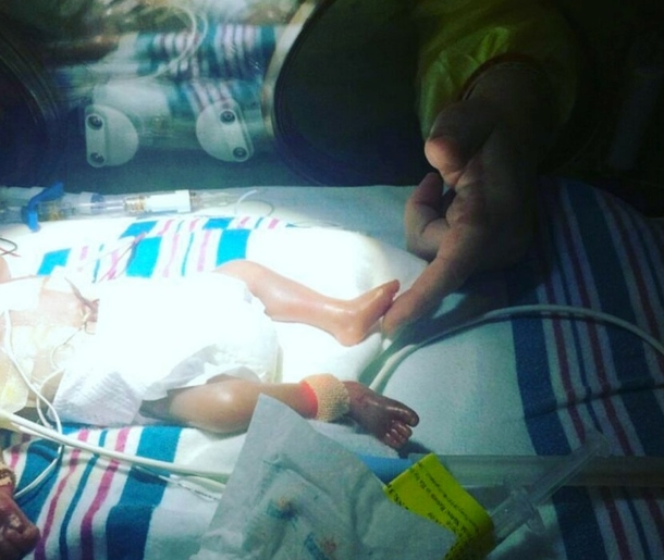 This mother left a glove on top of her preemie baby. The nurses were touched the next day - picture 3