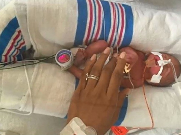 This mother left a glove on top of her preemie baby. The nurses were touched the next day - picture 4