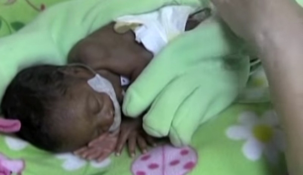 This mother left a glove on top of her preemie baby. The nurses were touched the next day - picture 6