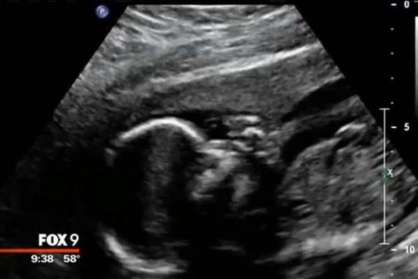 This Mother Sold Her Stillborn Baby's Crib At A Garage Sale. What Happened Next Made Me Cry. - picture 2