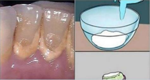 This Mouthwash Removes Plaque From Teeth In 2 Minutes - picture 2