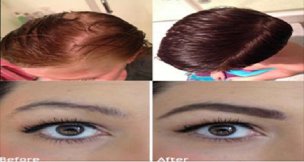 This Oil Is Perfect For Regrowing And Strengthening Hair, Eyelashes And Eyebrows - picture 2