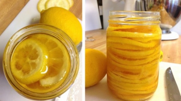 This Old German Remedy Clears Up Arteries In No Time At All! - picture 2