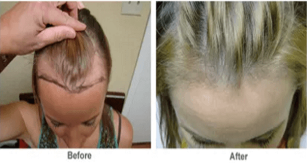 This Plant Can Cure Baldness and Rheumatism And You Probably Never Realized It Was In Your Garden! - picture 2