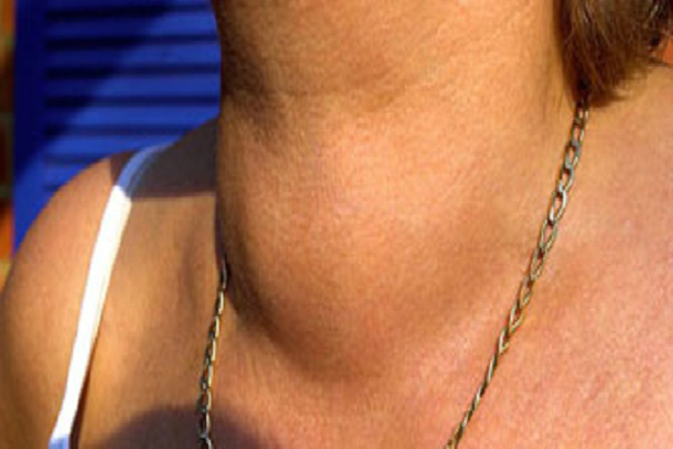 This Popular Drink Destroys Your Thyroid. Do You Drink It? - picture 2
