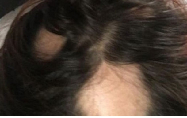 This Popular Shampoo Brand Is Causing People Across America To Lose Their Hair Overnight... - picture 2