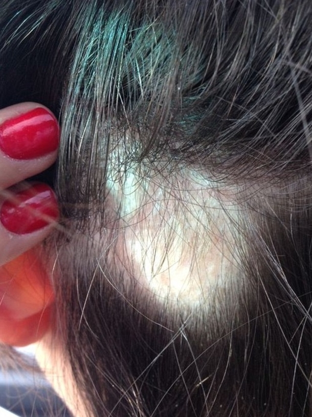 This Popular Shampoo Brand Is Causing People Across America To Lose Their Hair Overnight... - picture 3